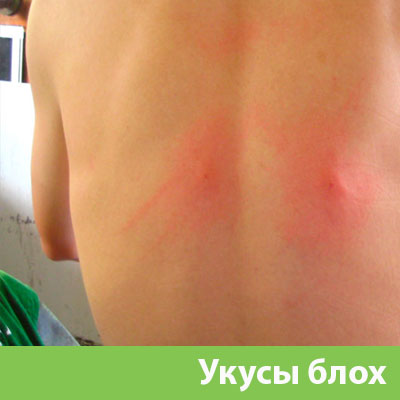 Укусы блох в Солнечногорске